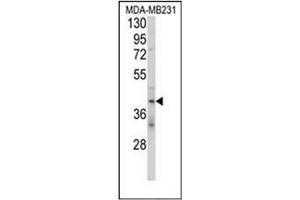 Western blot analysis of CD158d / KIR2DL4 Antibody (C-term) in MDA-MB231 cell line lysates (35ug/lane). (KIR2DL4/CD158d antibody  (C-Term))