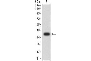 Western blot analysis using ALDH1A1 mAb against human ALDH1A1 (AA: 1-110) recombinant protein.