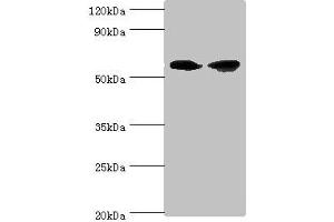 Western blot All lanes: AHCYL1 antibody at 12 μg/mL Lane 1: Hela whole cell lysate Lane 2: 293T whole cell lysate Secondary Goat polyclonal to rabbit IgG at 1/10000 dilution Predicted band size: 59, 54 kDa Observed band size: 59 kDa (AHCYL1 antibody  (AA 31-260))