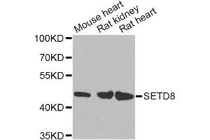 Western blot analysis of extracts of various cell lines, using SETD8 Antibody (ABIN5974407) at 1/1000 dilution.
