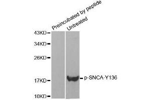 Western blot analysis of extracts from mouse brain tissue using Phospho-SNCA-Y136 antibody (ABIN2987740) and the same antibody preincubated with blocking peptide. (SNCA antibody  (pTyr136))