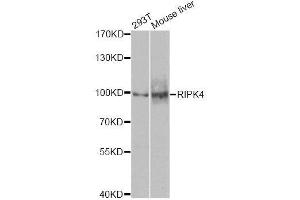 Western blot analysis of extracts of various cell lines, using RIPK4 antibody. (RIPK4 antibody  (AA 240-520))