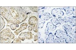 Immunohistochemistry analysis of paraffin-embedded human placenta tissue, using APOBEC3D/F Antibody. (APOBEC3D/F (AA 232-281) antibody)