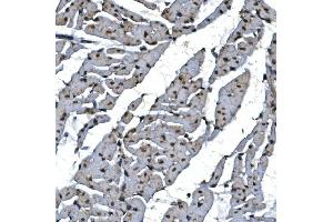 IHC analysis of TBP-1/PSMC3 using anti-TBP-1/PSMC3 antibody (ABIN7599393).