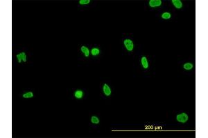 Immunofluorescence of monoclonal antibody to HNRNPG-T on HeLa cell. (RBMXL2 antibody  (AA 1-90))