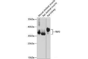 Western blot analysis of extracts of various cell lines using FBP2 Polyclonal Antibody at dilution of 1:1000. (FBP2 antibody)