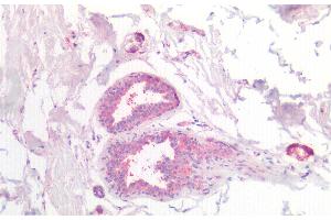 Detection of CSN2 in Human Breast Tissue using Polyclonal Antibody to Casein Beta (CSN2) (CSN2 antibody  (AA 41-198))