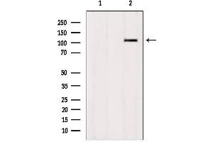 Western blot analysis of extracts from HepG2, using ZNF295 Antibody. (ZNF295 antibody  (N-Term))