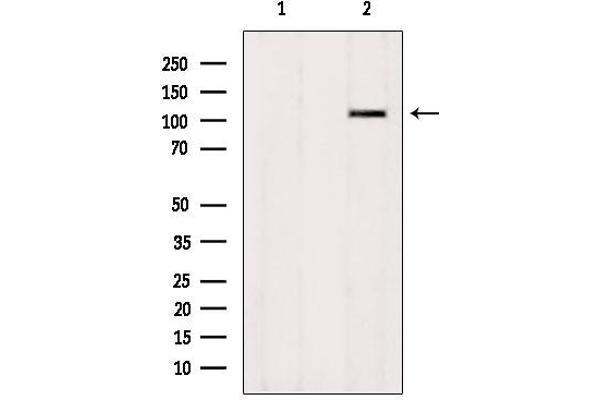 ZNF295 antibody  (N-Term)