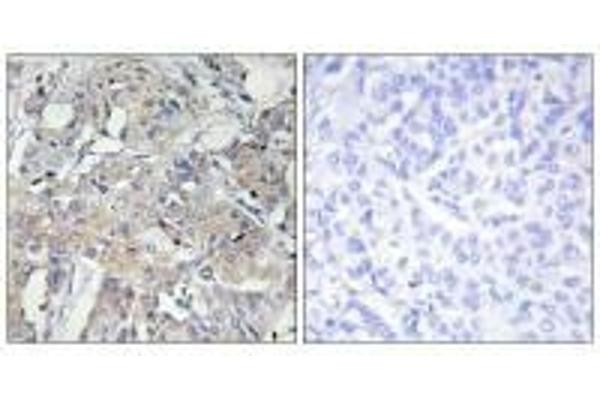 COL6a3 antibody