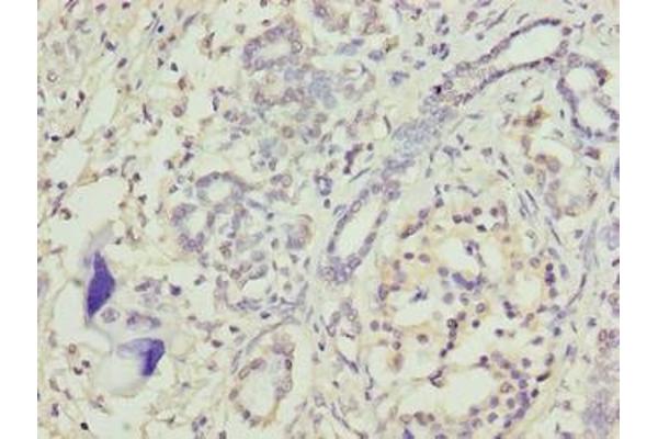 TRAM2 antibody  (AA 316-370)