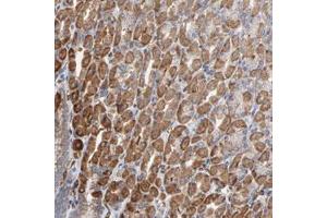 Immunohistochemical staining (Formalin-fixed paraffin-embedded sections) of human stomach with OXA1L polyclonal antibody  shows strong cytoplasmic positivity in glandular cells. (OXA1L antibody)
