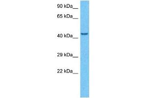 Host:  Rabbit  Target Name:  KCNJ6  Sample Type:  MCF7 Whole Cell lysates  Antibody Dilution:  1. (KCNJ6 antibody  (C-Term))