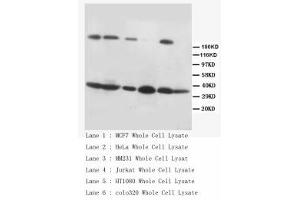 Image no. 2 for anti-Fas Ligand (TNF Superfamily, Member 6) (FASL) (C-Term) antibody (ABIN1492926) (FASL antibody  (C-Term))