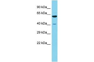 Host: Rabbit Target Name: RSRC1 Sample Type: 721_B Whole Cell lysates Antibody Dilution: 1. (RSRC1 antibody  (N-Term))