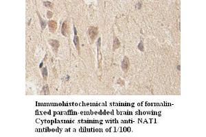 Image no. 1 for anti-N-Acetyltransferase 1 (Arylamine N-Acetyltransferase) (NAT1) antibody (ABIN791181) (NAT1 antibody)