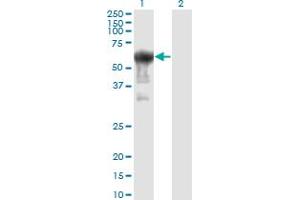 Western Blot analysis of PRUNE expression in transfected 293T cell line by PRUNE monoclonal antibody (M01), clone 1C11. (PRUNE antibody  (AA 1-453))