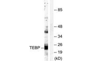 Western blot analysis of extracts from NIH-3T3 cells, treated with EGF 200ng/ml 30', using TEBP (Ab-113) Antibody. (NKX2-1 antibody  (AA 79-128))