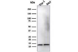 Western Blot Analysis of THP-1 and Raji Cell lysate using Beta-2-Microglobulin Mouse Monoclonal Antibody (B2M/1118). (beta-2 Microglobulin antibody)