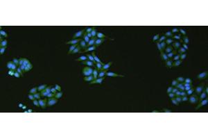Immunofluorescence analysIs of HepG2 cell using SLC18A3 Polyclonal Antibody at dilution of 1:50 (SLC18A3 antibody)