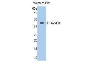 Western Blotting (WB) image for anti-Keratin 16 (KRT16) (AA 117-419) antibody (ABIN1172993) (KRT16 antibody  (AA 117-419))