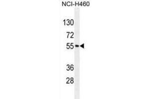 Western Blotting (WB) image for anti-Mesoderm Induction Early Response 1, Family Member 2 (MIER2) antibody (ABIN2996066) (MIER2 antibody)