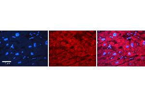 Immunohistochemistry (IHC) image for anti-Structural Maintenance of Chromosomes 1A (SMC1A) (C-Term) antibody (ABIN2780766)