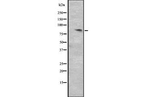 Western blot analysis of CCNT2 expression in HepG2 whole cell lysate ,The lane on the left is treated with the antigen-specific peptide. (Cyclin T2 antibody  (Internal Region))