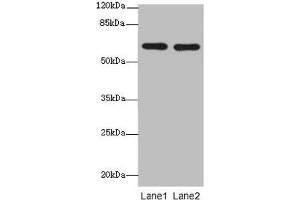 Western blot All lanes: CNOT2 antibody at 2 μg/mL Lane 1: 293T whole cell lysate Lane 2: Jurkat whole cell lysate Secondary Goat polyclonal to rabbit IgG at 1/10000 dilution Predicted band size: 60, 41, 23, 52, 55 kDa Observed band size: 60 kDa (CNOT2 antibody  (AA 1-335))