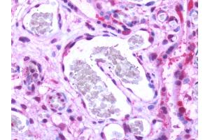 Human, Placenta: Formalin-Fixed Paraffin-Embedded (FFPE) (S1PR1 antibody  (Cytoplasmic Domain))