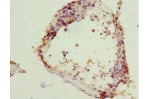 Immunohistochemistry of paraffin-embedded human testis tissue using ABIN7161952 at dilution of 1:100 (ZC3HC1 antibody  (AA 1-260))