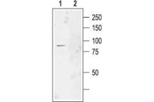 Chloride Channel 2 (CLCN2) peptide