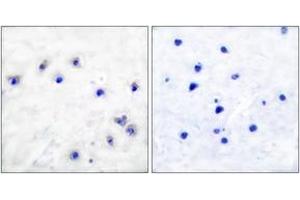 Immunohistochemistry analysis of paraffin-embedded human brain, using Tyrosine Hydroxylase (Phospho-Ser19) Antibody. (Tyrosine Hydroxylase antibody  (pSer18))