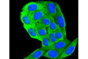Immunofluorescence (Cultured Cells) (IF (cc)) image for anti-Keratin 18 (KRT18) antibody (ABIN5557298)