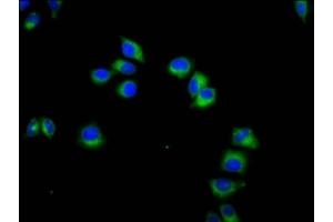 Immunofluorescence staining of Hela cells with ABIN7161649 at 1:133, counter-stained with DAPI. (KLRC3 antibody  (AA 94-240))