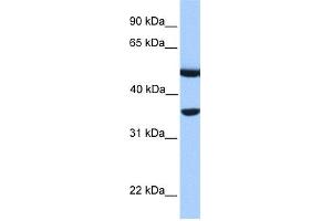 WB Suggested Anti-DNAJB6 Antibody Titration: 0. (DNAJB6 antibody  (N-Term))