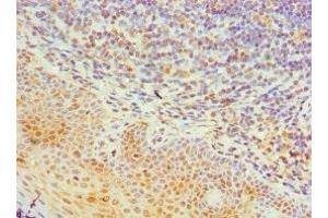 Immunohistochemistry of paraffin-embedded human tonsil tissue using ABIN7161993 at dilution of 1: 100 (TIA1 antibody  (AA 1-193))