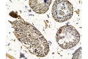 anti-Suppressor of Variegation 4-20 Homolog 1 (SUV420H1) antibody