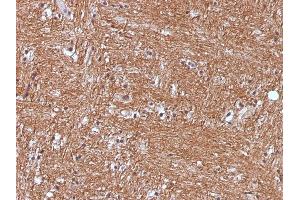 Formalin-fixed, paraffin-embedded human Cerebellum stained with NSE gamma Monoclonal Antibody (ENO2/1375). (ENO2/NSE antibody  (AA 416-433))