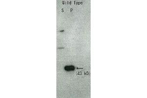 Western Blotting (WB) image for anti-Rqn1 (C-Term) antibody (ABIN2452117)