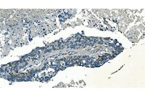 IHC analysis of PI-16/PI16 using anti-PI-16/PI16 antibody (ABIN7601074). (PI16 antibody  (AA 28-363))