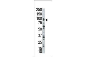Image no. 1 for anti-Muscle, Skeletal, Receptor Tyrosine Kinase (MUSK) (N-Term) antibody (ABIN359902)