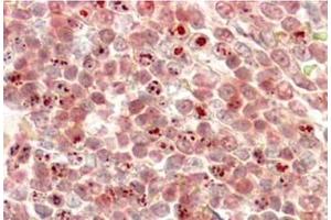 AP32078PU-N MLL2 Antibody staining of paraffin embedded Human Liver at 3. (MLL2 antibody  (N-Term))
