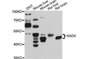 Western blot analysis of extracts of various cells, using NADK antibody. (NADK antibody)