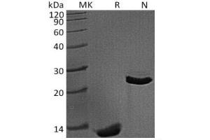 Western Blotting (WB) image for Transforming Growth Factor, beta 1 (TGFB1) (Active) protein (ABIN7320668) (TGFB1 Protein)