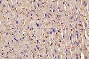 Immunohistochemistry analysis of paraffin-embedded rat heart using,AKAP13 (ABIN7072867) at dilution of 1: 8000
