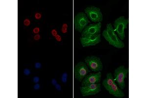 ABIN6258036 and ABIN6274198 staining Hela by IF/ICC. (CSRP1 antibody  (Internal Region))