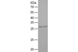 Western Blotting (WB) image for Sirtuin 3 (SIRT3) (AA 118-399) protein (His tag) (ABIN7289054) (SIRT3 Protein (AA 118-399) (His tag))