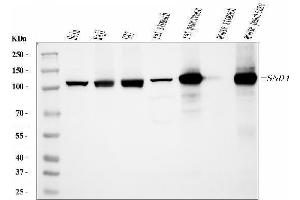 Western blot analysis of SND1 using anti-SND1 antibody (ABIN7600525).