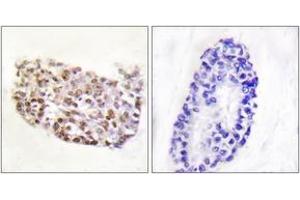 Immunohistochemistry analysis of paraffin-embedded human thyroid gland tissue, using NFAT5 (Ab-1197) Antibody. (NFAT5 antibody  (AA 1171-1220))